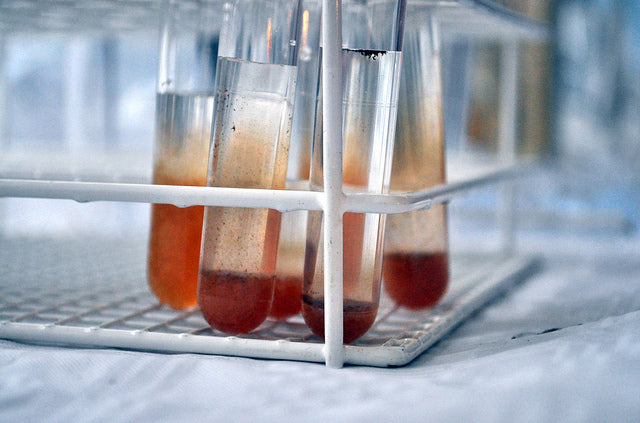 24-Hour Urine Calcium Test Directions and Interpretation