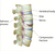 Compression Fractures of the Spine