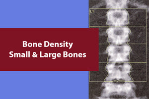 Bone Density and Fracture Risk for Various Bone Sizes