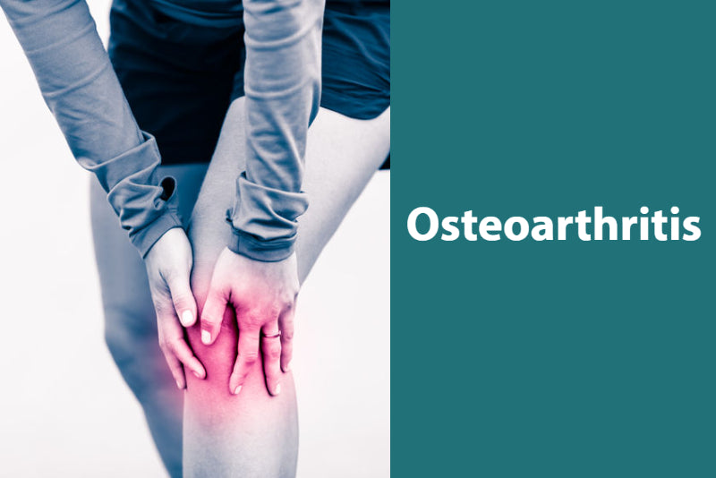 Osteoarthritis Prevention and Treatment Options: Video