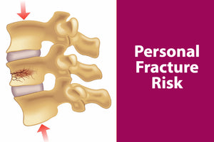 Personal Fracture Risk